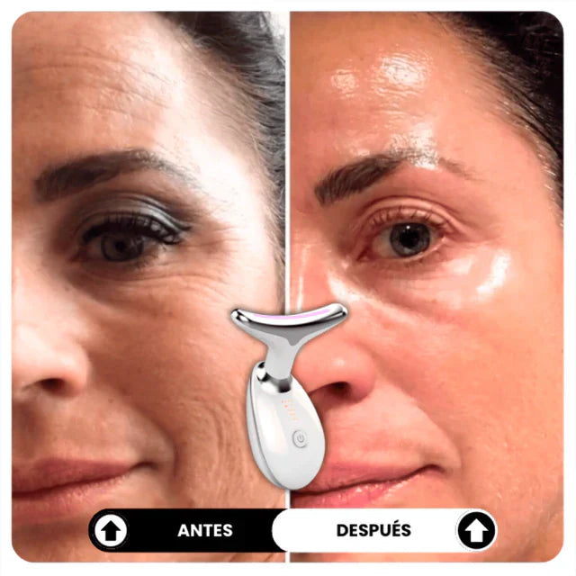 FaceGlow® Mejora y Rejuvenece tu Piel + Serum Vitamina C de REGALO