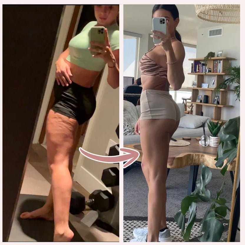 Calza 3D Anti-Celulitis • Definí, Moldeá y Reducí la Apariencia de Celulitis al Instante